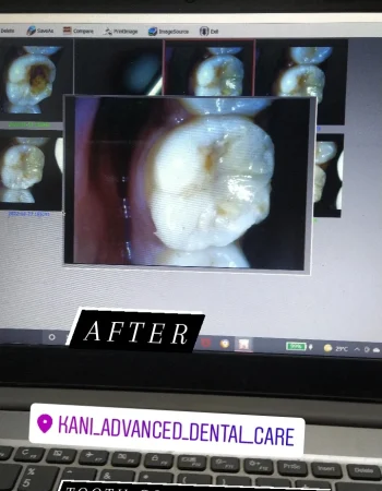 KANI ADVANCED DENTAL CARE