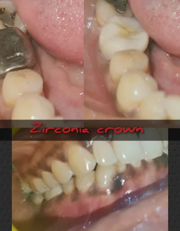 Dr.Anu’s Tooth Care Dental Clinic