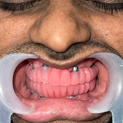 Narayani Dental Clinic