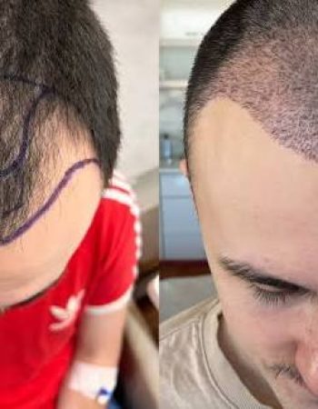BCR Hair Fixing Center