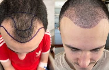BCR Hair Fixing Center
